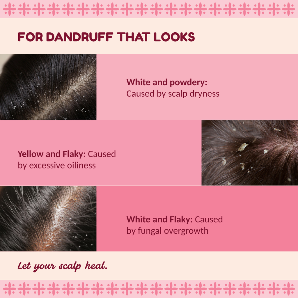 Scalp Therapy Spray Mist