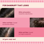 Scalp Therapy Spray Mist