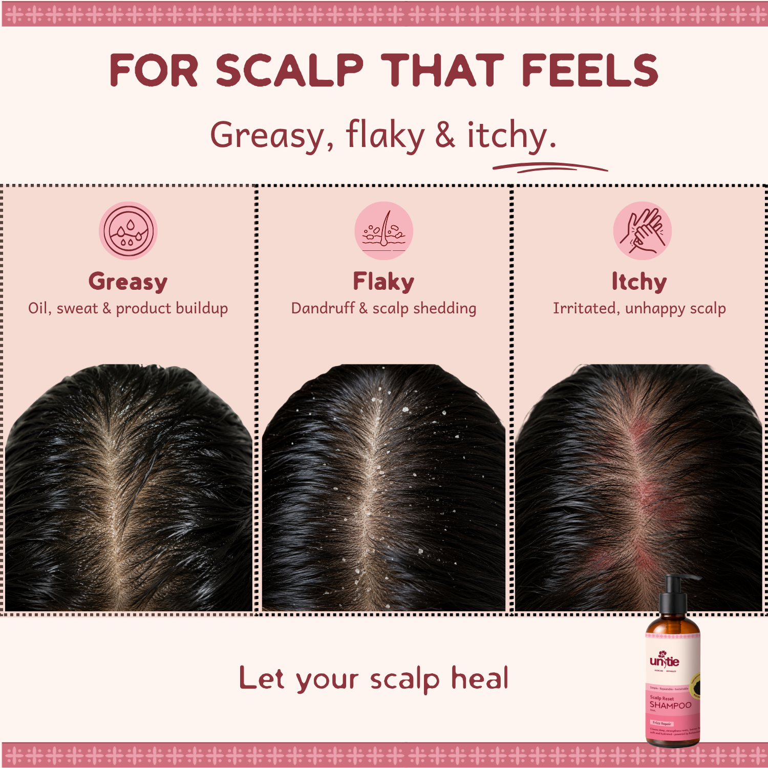 Scalp Reset Shampoo